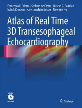 Hardcover Atlas of Real Time 3D Transesophageal Echocardiography [With CDROM] Book