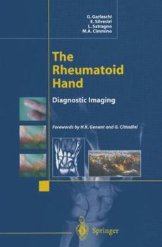 Paperback The Rheumatoid Hand: Diagnostic Imaging Book