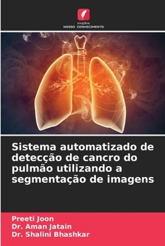 Paperback Sistema automatizado de detecção de cancro do pulmão utilizando a segmentação de imagens [Portuguese] Book