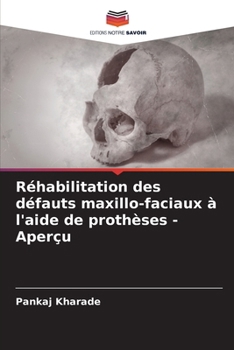 Paperback Réhabilitation des défauts maxillo-faciaux à l'aide de prothèses - Aperçu [French] Book