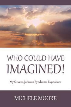Paperback Who Could Have Imagined!: My Stevens-Johnson Syndrome Experience Book