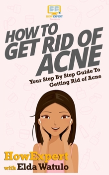 Paperback How To Get Rid of Acne: Your Step By Step Guide To Getting Rid of Acne Book