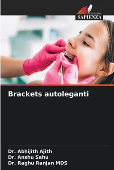 Brackets autoleganti (Italian Edition)