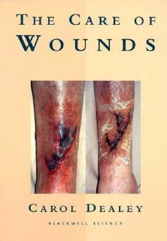 Paperback The care of wounds: a guide for nurses Book