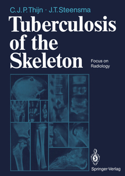 Paperback Tuberculosis of the Skeleton: Focus on Radiology Book