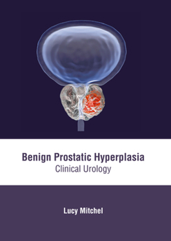 Hardcover Benign Prostatic Hyperplasia: Clinical Urology Book