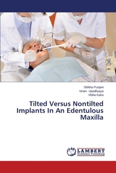 Paperback Tilted Versus Nontilted Implants In An Edentulous Maxilla Book