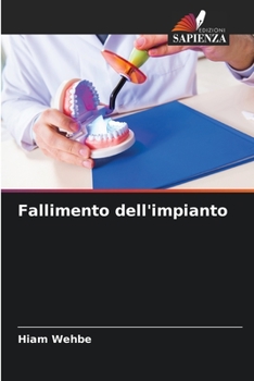 Paperback Fallimento dell'impianto [Italian] Book