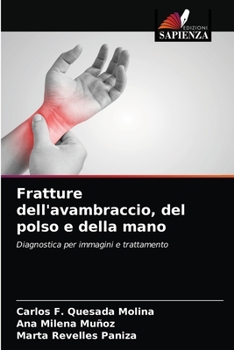 Paperback Fratture dell'avambraccio, del polso e della mano [Italian] Book