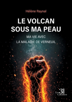 Paperback Le volcan sous ma peau: Ma vie avec la maladie de Verneuil [French] Book