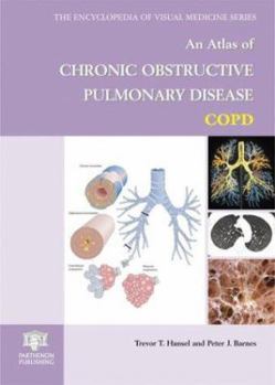 Hardcover An Atlas of Chronic Obstructive Pulmonary Disease Book