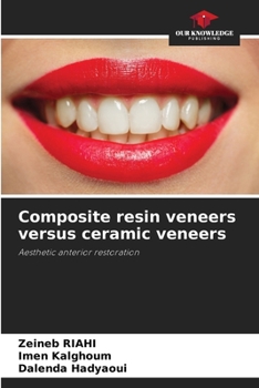 Paperback Composite resin veneers versus ceramic veneers Book