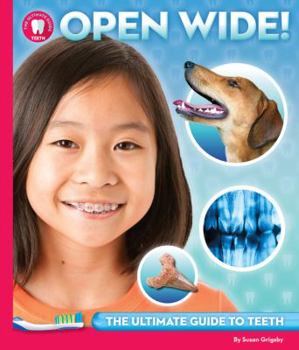 Hardcover Open Wide: The Ultimate Guide to Teeth Book