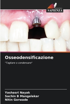 Paperback Osseodensificazione [Italian] Book