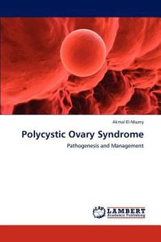 Paperback Polycystic Ovary Syndrome Book