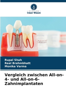 Paperback Vergleich zwischen All-on-4- und All-on-6-Zahnimplantaten [German] Book