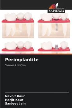 Paperback Perimplantite [Italian] Book