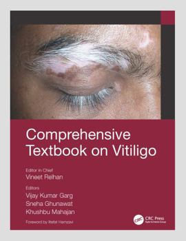 Paperback Comprehensive Textbook on Vitiligo Book