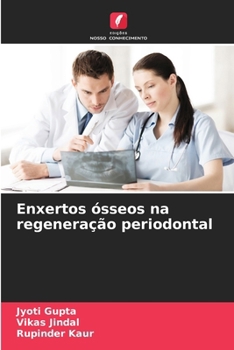 Paperback Enxertos ósseos na regeneração periodontal [Portuguese] Book