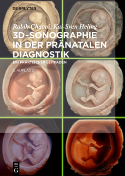 Hardcover 3d-Sonographie in Der Pränatalen Diagnostik: Ein Praktischer Leitfaden [German] Book