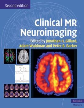 Hardcover Clinical MR Neuroimaging: Physiological and Functional Techniques Book