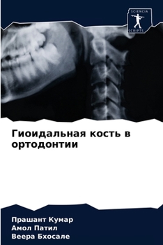 Гиоидальная кость в орто