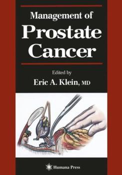 Paperback Management of Prostate Cancer Book