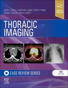 Paperback Thoracic Imaging: Case Review Book