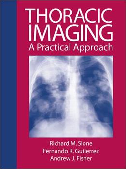 Hardcover Review of Thoraic Imaging and Chest Disease Book