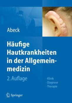 Hardcover Häufige Hautkrankheiten in Der Allgemeinmedizin: Klinik, Diagnose, Therapie [German] Book