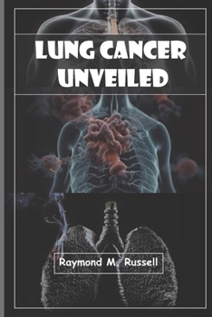 Paperback Lung Cancer Unveiled: Empowering Patients, Caregivers, Advocates, Understanding, Managing, Surviving, with Expert Insights, Latest Research, Book