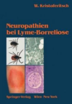 Paperback Neuropathien Bei Lyme-Borreliose [German] Book