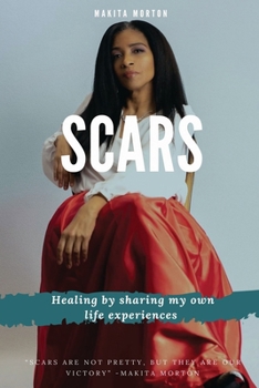 Paperback Scars: Healing by sharing my own life experiences Book