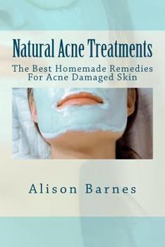Paperback Natural Acne Treatments: The Best Homemade Remedies For Acne Damaged Skin Book