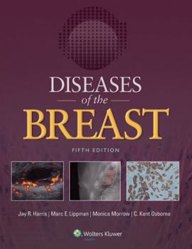 Hardcover Diseases of the Breast 5e Book