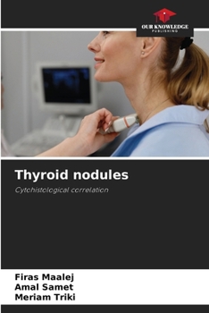 Paperback Thyroid nodules Book