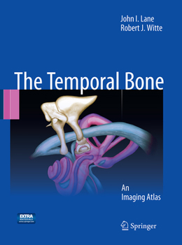 Paperback The Temporal Bone: An Imaging Atlas Book