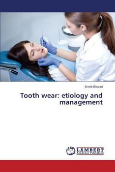 Paperback Tooth wear: etiology and management Book