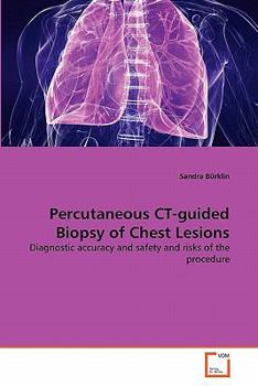 Paperback Percutaneous CT-guided Biopsy of Chest Lesions Book