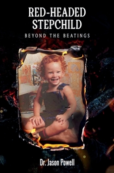 RED-HEADED STEPCHILD