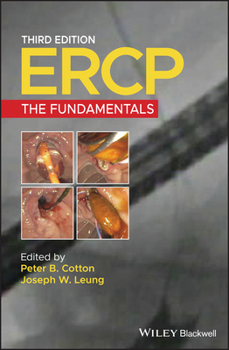 Hardcover Ercp: The Fundamentals Book