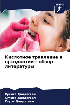 Paperback Кислотное травление в ор [Russian] Book