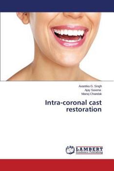 Paperback Intra-coronal cast restoration Book