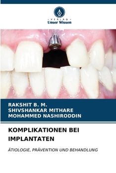 Paperback Komplikationen Bei Implantaten [German] Book