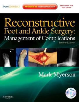 Hardcover Reconstructive Foot and Ankle Surgery: Management of Complications: Expert Consult - Online, Print, and DVD Book