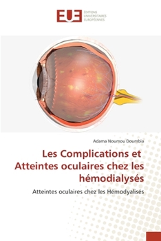 Les Complications et Atteintes oculaires chez les hémodialysés