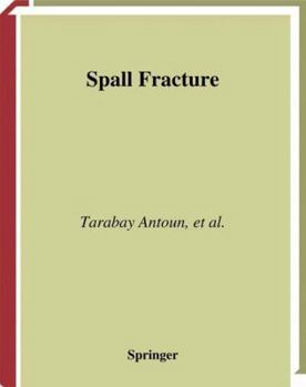 Paperback Spall Fracture Book