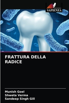 Paperback Frattura Della Radice [Italian] Book