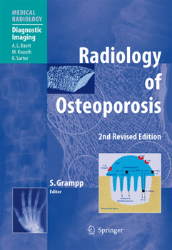 Paperback Radiology of Osteoporosis Book