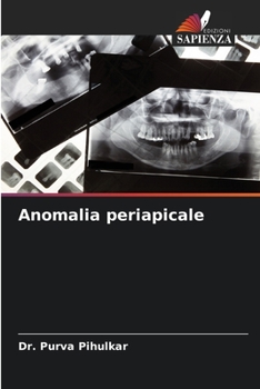 Anomalia periapicale